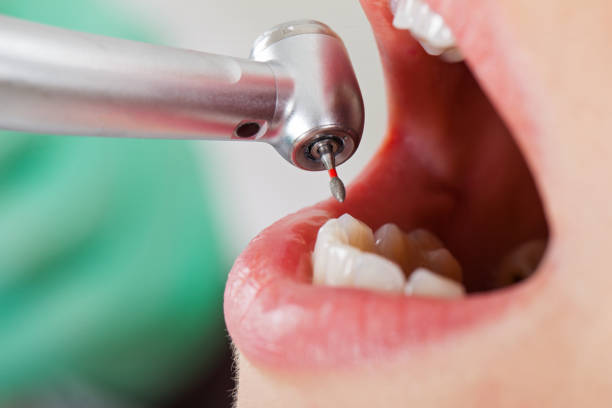 Best Broken or Chipped Tooth Repair in Winder, GA
